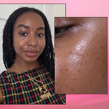 Image result for Freckled skin