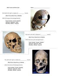 Previous studies have shown inflicting injury to the head region is one of the most effective methods of murder. Skull Trauma And Bones