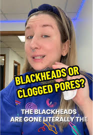 Isntree Chestnut Aha 8 Essence