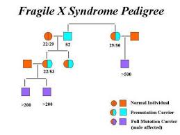 Fragile X Syndrome Pictures