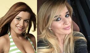 В комментариях тут же начали атаковать бизнесмена: Kseniya Borodina Do I Posle Plastiki Byli Li Plasticheskie Operacii Novosti I Foto 2021