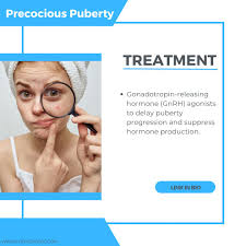 Image result for Precocious Puberty
