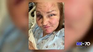 Fargo woman speaks out