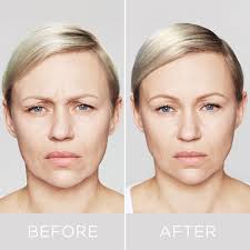 Dr Kathryn Hogg, Facial Aesthetics Consultant