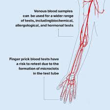 Image result for Venous Blood Sampling
