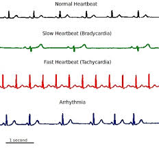 circulatory systems in animals transport systems in