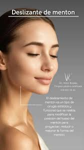 #deslizante #menton #cirujanoplástico #cirujanoplasticocertificado  #losmejores