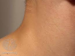These lumps can be red, pink, or blue. How To Tell A Lump From A Lymph Node