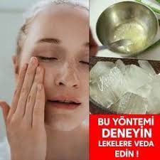 Gunes Lekesi Lazer Lekesi Akne Ve Sivilce Lekeleri Ciltte Kararmalar Ve Kizarmalalar Tum Bunlara Dogal Guzellik Ipuclari Dogal Cilt Bakimi Cilt Bakimi