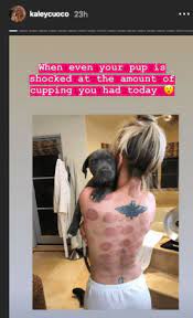 Jun 24, 2021 · read on to help narrow your search and learn about 10 cbd oils and tinctures and their uses. Big Bang Theory S Kaley Cuoco Shares Painful Backless Photo On Instagram Ibtimes India