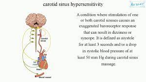 Carotid Sinus Hypersensitivity Youtube