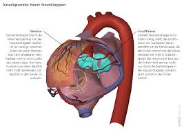 Herzklappen Operation Mittels Katheter Durch Uber Die Leiste Der Spiegel