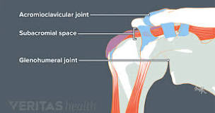 Image result for icd 10 code for left shoulder subacromial bursitis