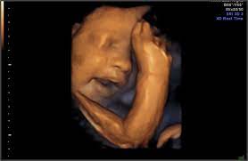 I'm only at 31 weeks, but i had that 4d/3d u/s and yes, baby looked totally deformed. Pregnancy Week 31