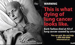 Graphic Images Of People Dying From Lung Cancer To Go On Cigarette Packets Daily Mail Online