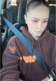 Discover Natural Weight Loss with Ginger Water Benefits