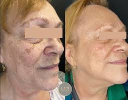 Wishing a very Happy National Physician's Day to our esteemed Medical  Director, Dr. Kelley Wright. Your leadership, expertise, and commitment to  excellence are invaluable to 413 Medical Aesthetics and to the other