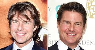 Tom Cruise S Face At Baftas Prompts Twitter Reaction See Why Plastic Surgery Face Surgery Celebrity Plastic Surgery