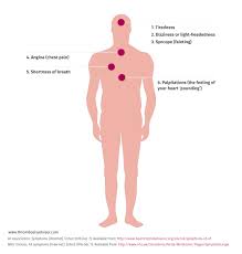 Upper back pain and chest pain can occur together. Signs And Symptoms Of Atrial Fibrillation