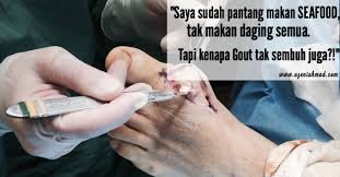 Vitamin bite cara paling mudah singkirkan asid urik berlebihan penyebab gout. Cara Singkirkan Asid Urik