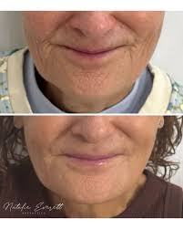 Natalie Everett Aesthetics (@natalie.everett.aesthetics) • Instagram photos  and videos