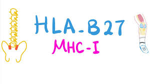 Human leukocyte antigens (hlas) are proteins that help the body's immune system tell the difference between its own cells and foreign. Human Leukocytic Antigen B27 Hla B27 Youtube