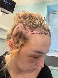 Teacher battles through six brain tumour operations to pursue Miss England  dream