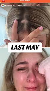 The Feeling of Being Bald