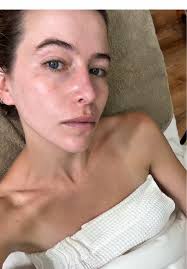 Nyc Oasis Tmj Treatment Spa