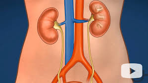 Treating Kidney Stones In Children At Chop S Pediatric Stone Center Children S Hospital Of Philadelphia