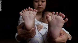 ألمانيا تحذر تركيا من ابتزاز الاتحاد الأوروبي بخصوص اللاجئين Chinese Babies Three Month Old Baby Born In China