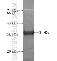 Rtp1 has a variety of programs Rtp1 Fusion Protein Ag6934 Proteintech