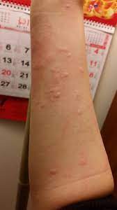 Pin On Health