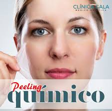 El peeling químico es un tratamiento estético aplicado por profesionales expertos en estética, que se basa en la aplicación de ciertas sustancias químicas sobre las capas superiores de la piel. Peeling Quimico Clinica Gala