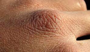 Which Alcohols Are Safe In Skin Care 100 Pure