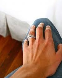 Nope That Itchy Rash Around Your Ring Finger Doesn T Mean You Re Allergic To Commitment It Means Your Band Is Probab Wedding Ring Rash Wedding Rings Wedding