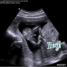 Catch A Glimpse 4d Liverpoolhow Do We Differentiate Genders On Ultrasound Catch A Glimpse