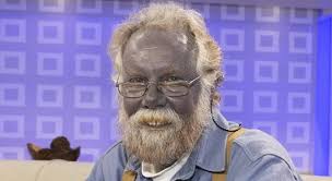 The Blue People Of Kentucky Sick Chirpse In the late 1950s, a hematologist named martin cawein from the university of kentucky was fascinated by the stories of the blue fugate family. the blue people of kentucky sick chirpse