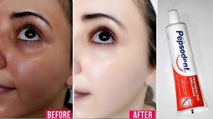 Cara Memutihkan Wajah Dengan Pasta Gigi Kulit Kinclong Glowing Putih Permanen Youtube
