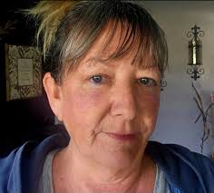 Does this rash look like lupus?