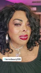 How to Cover Skin Burnsfrom Wax with Makeup