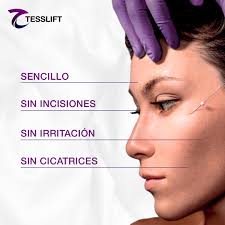 El proceso de lifting con mallas Tesslift Soft es sencillo y sin  incisiones. No deja cicatrices y reduce la sensación de irritación en la  piel. ¡Un lifting sin cirugía único en el