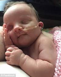 Baby girl dies month after stroke left her in a coma with family's dog  refusing to leave her