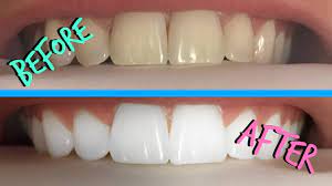 Also known as sodium bicarbonate, baking soda is a very fine, crystalline white powder that is composed of sodium and bicarbonate ions.5 this substance is an alkaline — when you blend it with an acid, it can change its ph level.6. Whiten Teeth Naturally And Fast Youtube