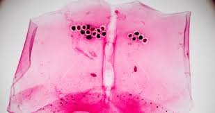 Image result for Berdazimer