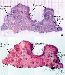 Human skin color ranges in variety from the darkest brown to the lightest hues. Human Skin Under Microscope Labeled Confocal Mosaicing Microscopy Of Human Skin Ex Vivo Spectral Photo Human Microscopic Photography Human Anatomy Chart Skin