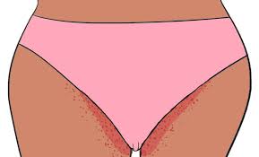 What are brazilian and bikini laser hair removal? Pin On My Style