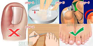 Pin On Health Tips Helpful Info