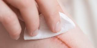 Ajar,program,komputer (untuk mencari kata ajar, program dan komputer). 8 Obat Pengering Luka Agar Lebih Cepat Sembuh