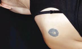 The canucks placed forward jake virtanen on leave saturday following allegations of sexual misconduct. Victoria Dermatologist Uses Laser To Get Rid Of Unwanted Tattoos Times Colonist